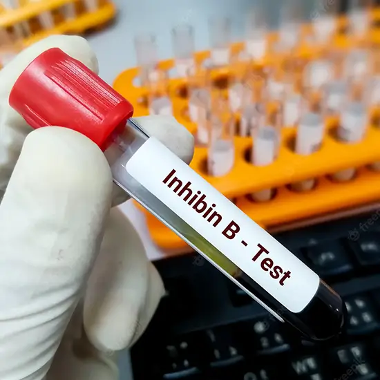 Inhibin B Test